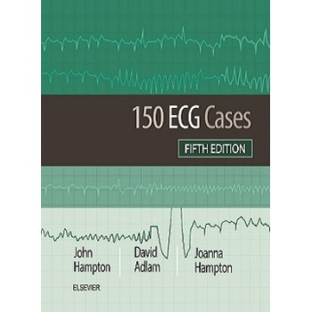 کتاب 150 ECG cases ویرایش پنجم 2019 اثر هامپتون